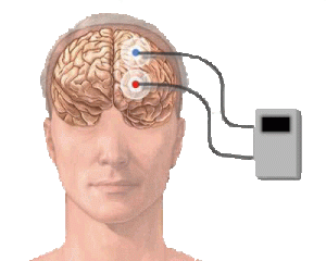brain-wave-monitor